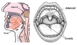Adenoidid