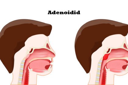 Adenoidid