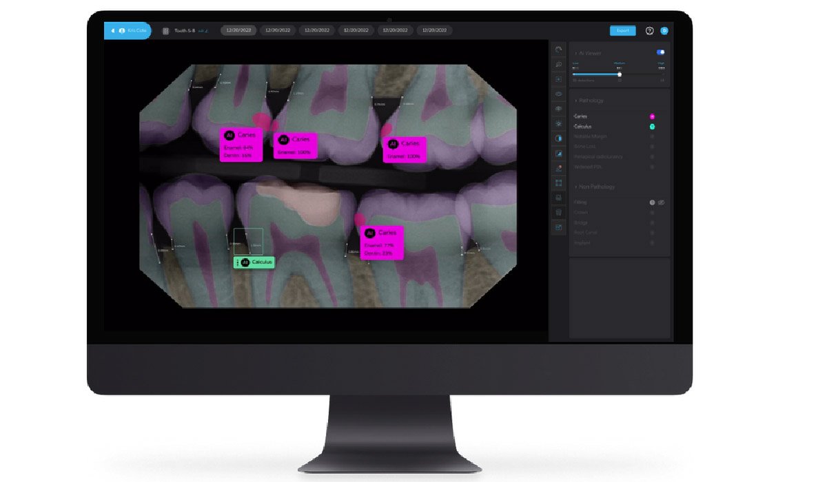 Nerovet AI Dentistry