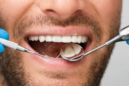 Dental Implants