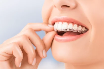 Invisalign