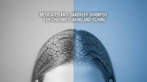 Medicated Anti-Dandruff Shampoo
